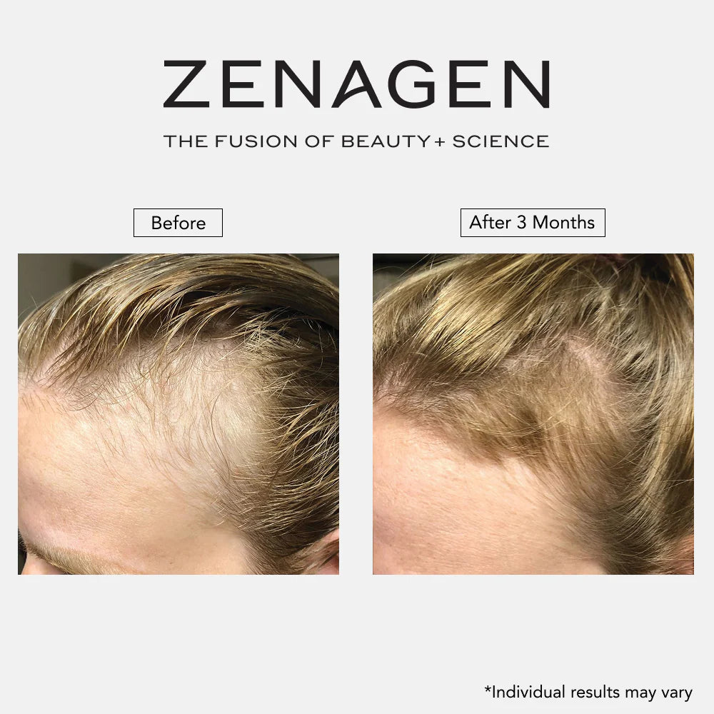 Revolve Thickening Shampoo for Women